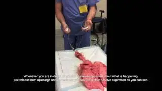 Introduction Tritube - Ventrain ventilation and equilibration by Prof. Dr. med. Enk