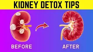 Top 15 Natural Ways to Decrease Creatinine & Improve GFR