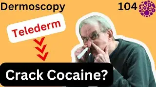 Is Telederm  the crack cocaine of Primary Care Dermatology?