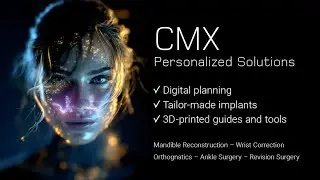 CMX - Personalized Solutions