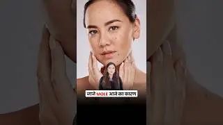 Moles Kyun Hote Hain? | Dermatologist
