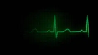 ekg flatline