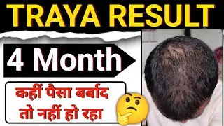 Traya Result After 4 Month | Traya Hair review
