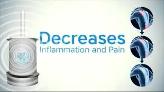 Dr. Michael Robb of Scottsdale's - FIX24 Wellness Studio on Wave Therapy