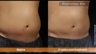 Slim Sure Robot by  Sculpt sure