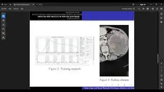Fuzzy Logic and Neural Networks for Disease Detection and Simulation in MATLAB
