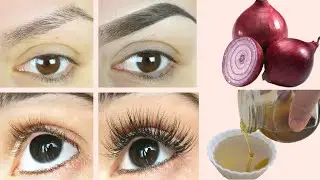 ONION-OIL to Grow LONG EYELASHES & EYEBROWS -  Eyebrows & Eyelash Growth Oil | Natural Beauty Tips