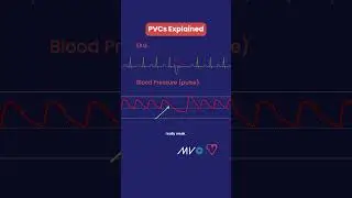 Объяснение ЖЭ ❤️⚡️