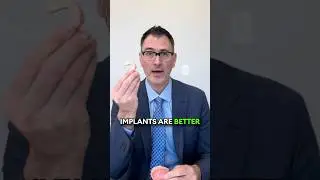 Should You Get Dentures or Dental Implants? 🤔🦷 #allon4dentalimplants #explained #dentist