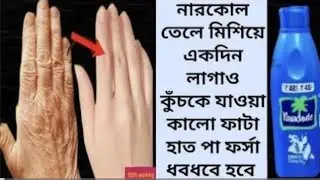 নারকোল তেলে মিশিয়ে লাগাও রুক্ষ ফাটা কালো হাত পা রাতারাতি ফর্সা ধবধবে হবে