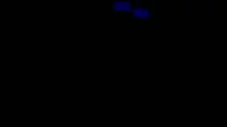 Venoscope Squad Glowstringing