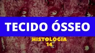 TECIDO ÓSSEO - HISTOLOGIA 14