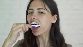 What HAPPENS if You Have Braces and DON'T Brush Your Teeth