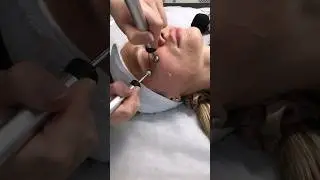 Microcurrents (eyes) in Doskonala beauty salon (Kyiv)