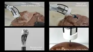 3D Bioprinter Prints Tissue in Situ