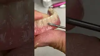 Finalizing the Details of a Denture