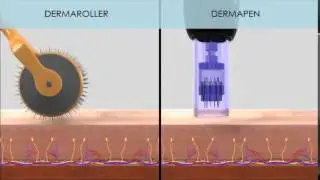 NUTRA SYSTEM  - DERMAPEN&DERMASTAMP (Fraksiyonel Mikro İğneleme Sistemleri)