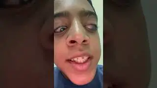 ‏قصص الطفولة ‏صدمتني ‏سيارة 😌😌😌￼￼￼￼