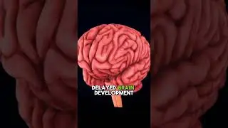 What Is Flat Head Syndrome? Let's talk about Plagiocephaly with Dr. Jess