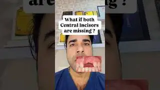 BOTH CENTRAL INCISORS MISSING #dentaleducation #dentaltips #dentistry #dentalexperts #dentalshorts