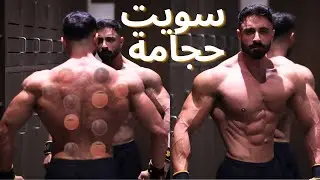 فوائد الحجامة للجسم والعضلات