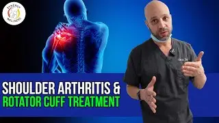 Shoulder Arthritis & Rotator Cuff Treatment with Cold Laser Therapy