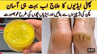 How to get rid off crack heels | Soft and Smooth Feet in 3 Days | Husnology by Iqra 