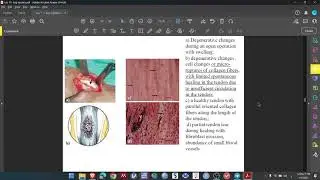 Lec 11 Sports (Part 2) - Overuse Leg Injuries