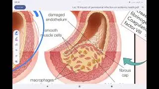 Periodontology lec impact of periodontal disease on systemic health مرحلة رابعة طب أسنان
