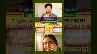 STOP Using Chemicals Whiten Teeth Naturally\പല്ല് മുത്തുപോലെ തിളങ്ങാൻ #drshamsheeronathukattil
