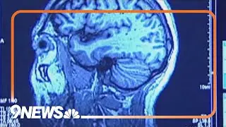 New research shows antidepressants work, just not the way many originally thought