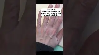 Get rid of hand's wrinkles| wrinkled hands #wrinkles #shorts #skin