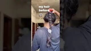 DIY HAIR GROWTH SERUM ✅✨#haircare #longhairgrowthtips #hairgrowth #haircaretips #shortsfeed #shorts