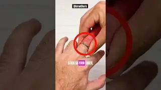 How To Remove a Stuck Ring! 😨