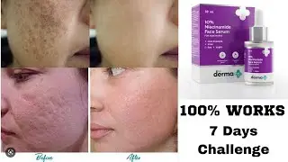The Derma Co. Niacinamide Serum Demo & Review | How To Use Niacinamide Serum For Acne Scars marks