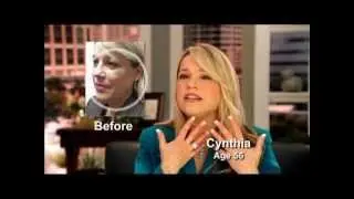 Patient Testimonial:  Lifestyle Lift Patient Cynthia