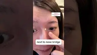 Reduce your tired eyes instantly with acupressure