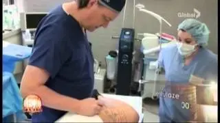Entertainment Tonight Canada - Rice Cosmetic Surgery - Cellulaze