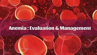 Anemia || Evaluation and Management