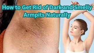 How to Get Rid of Dark and Smelly Armpits Naturally & Effectively