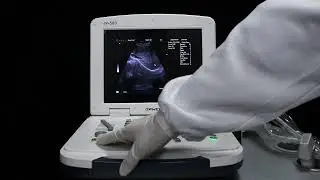 How do I use ultrasound machines in clinical practice?