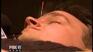 Acupuncture: Facing Your Fear of Needles (Milwaukee Acupuncture & Holistic Health Associates)