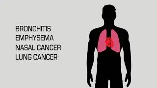Dangers of Construction Dust Exposure