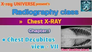 Chest Decubitus View (Part - 7) - Radiography Positioning