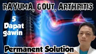 RAYUMA,GOUT ARTHRITIS,5 DAPAT GAWIN, PERMANENT SOLUTION