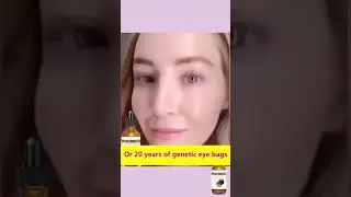 Milia Removal Essence