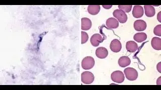 Мазки крови, окрашенные по методу Райта-Гимзы, содержащие Trypanosoma Brucei.
