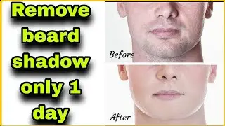 how to remove beard shadow !