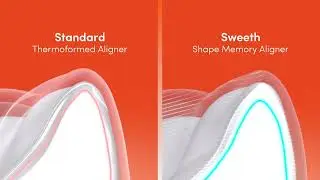 Sweeth Shape Memory Aligners  |  3D-printed Aligners vs Thermoformed Aligners
