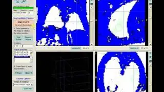 Mouse MRI Lung Segmentation with ITK-Snap